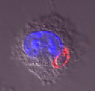 A single nonreplicating cps parasite inside a tumor cell