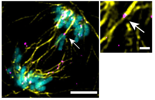 Image of an H1 hPSCs with a lagging chromosome in anaphase (image by C. Deng).