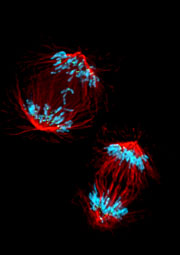 Two anaphase spindles from the control (lower) and Kif2b-depleted (upper) cells.  The chromosomes are in  blue, and the upper spindle contains two lagging chromosomes—shown in the middle.