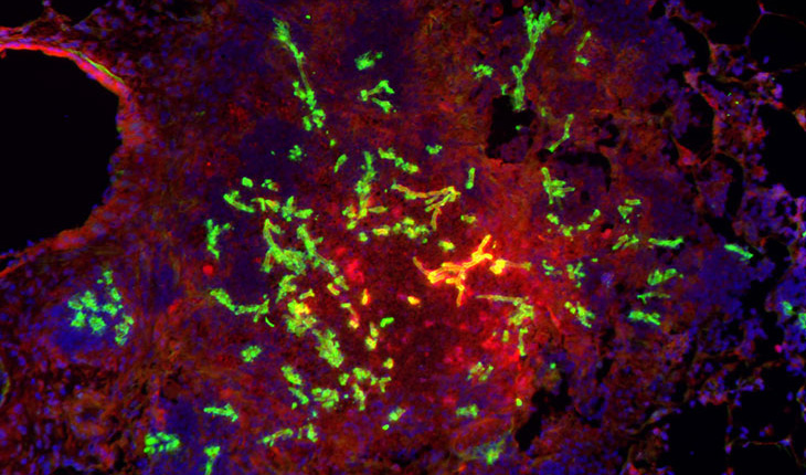 When the fungus Aspergillus fumigatus (shown in green) infects a lung, it triggers an influx of immune cells (blue), which use up available oxygen, creating areas of hypoxia (red). (Image courtesy of the Cramer Lab)