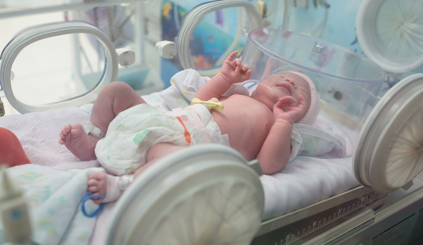 NICU Admissions Increasing for Normal Birth Weight and Term Infants