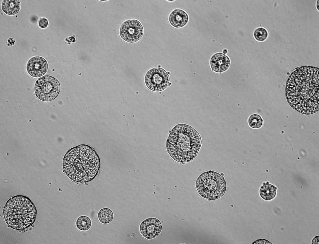 Microscopic image of induced Pluripotent Stem Cells (iPSCs) embryoid bodies grown on Matrigel.